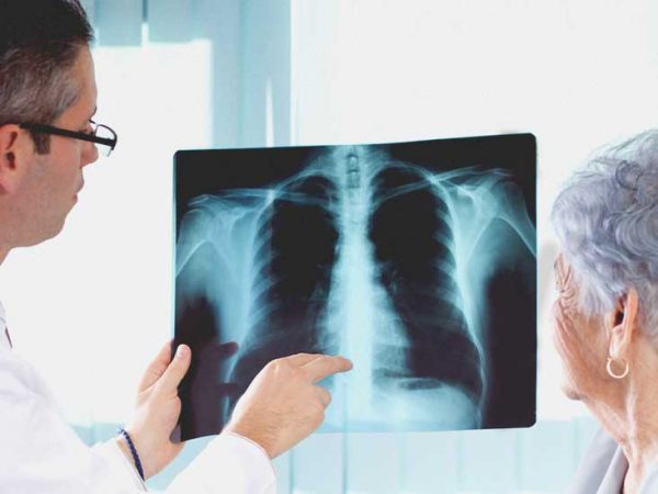 chuẩn đoán viêm phổi
